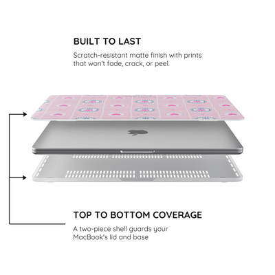 Sweet Stitches - MacBook Pro Case