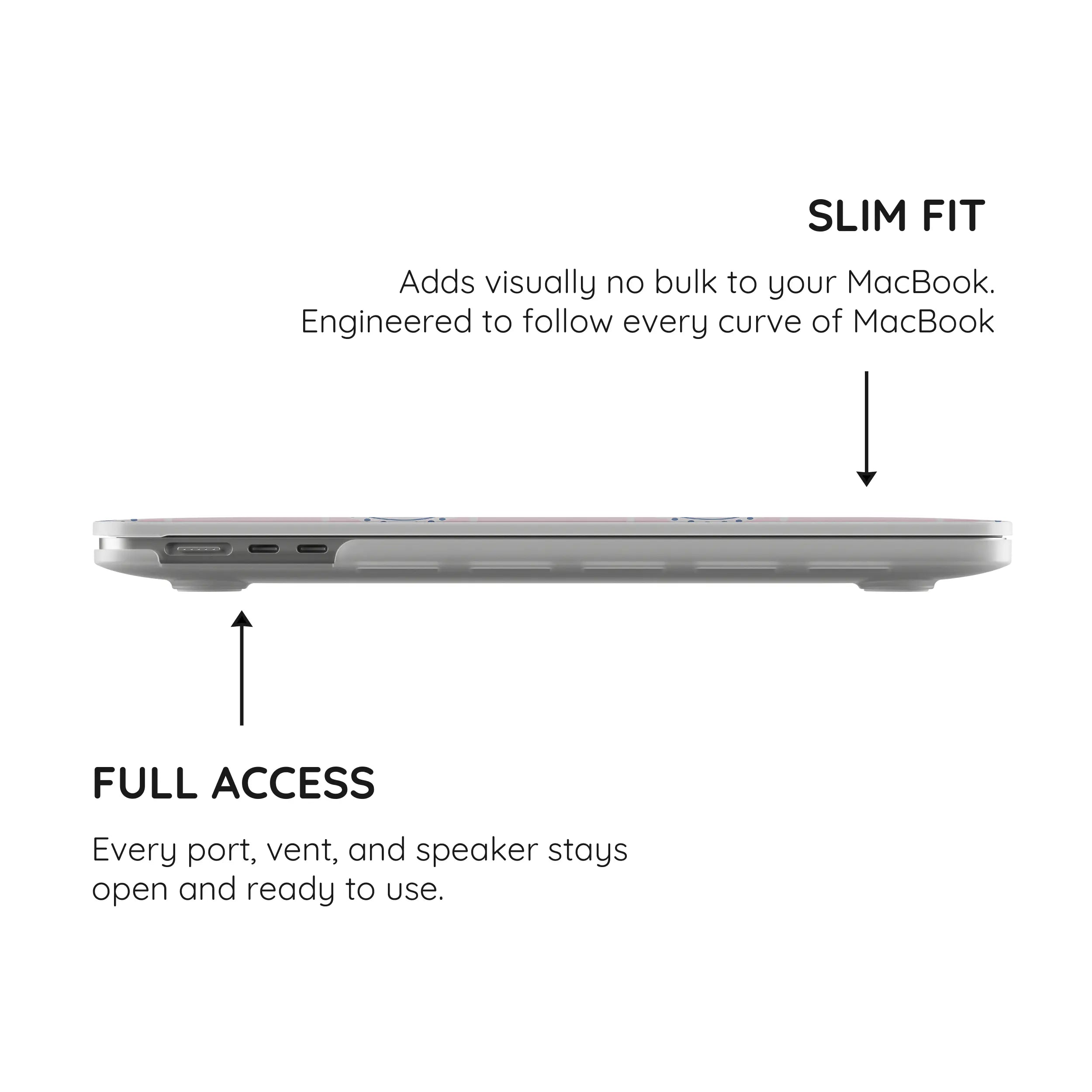 Sweet Stitches - MacBook Pro Case