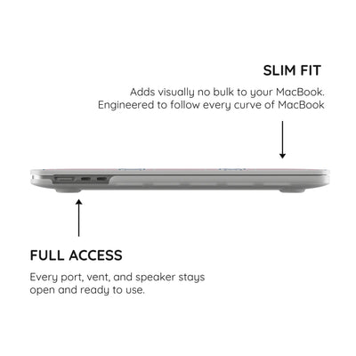 Sweet Stitches - MacBook Pro Case