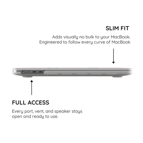 Sweet Stitches - MacBook Pro Case